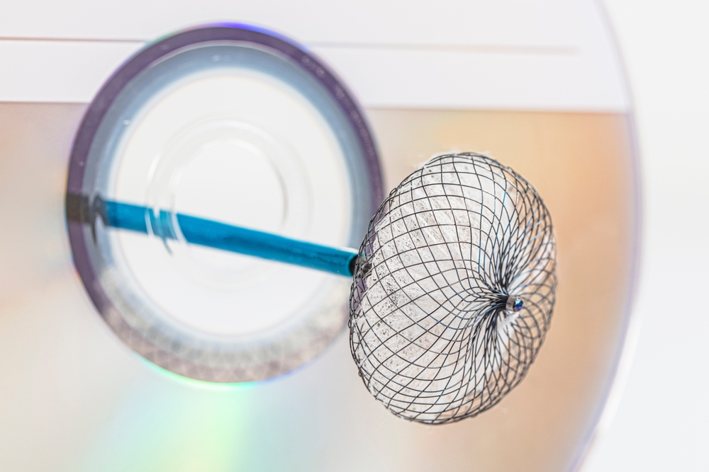 A high-tech cardiac implant device shown close-up, illustrating the complex engineering involved in medical device liability claims.